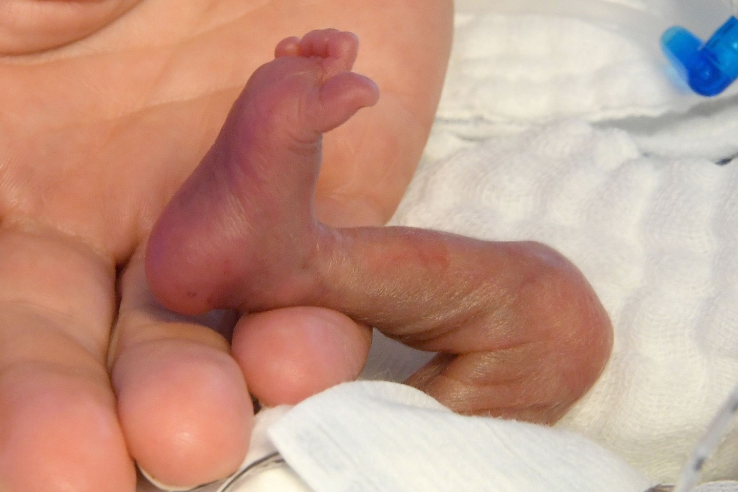 Der direkte Hautkontakt von Frühchen und Mutter bzw. Betreuungsperson noch vor dem Brutkasten kann einen positiven Einfluss auf die Entwicklung der Kinder haben.